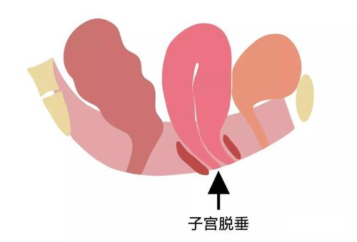 u=3144683185,708161526&fm=15&gp=0.jpg