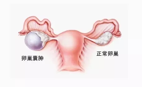 n2.webp.jpg